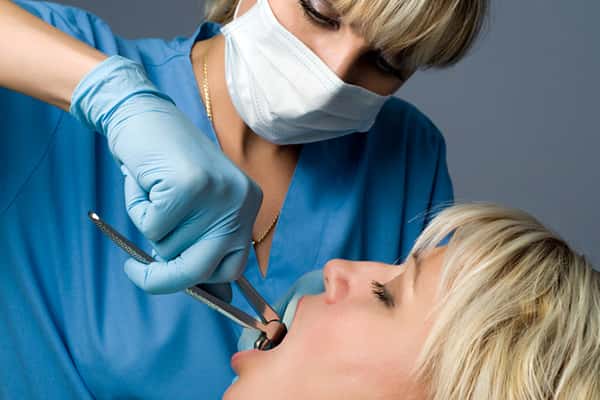 Extractions in Canton MA.