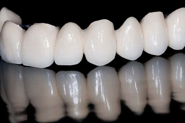 Dental Bridges in Canton MA.
