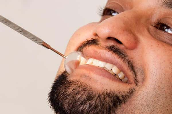 Dental Inlays and Onlays in Canton MA.
